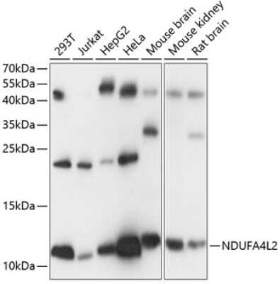 Western Blot: NDUFA4L2 AntibodyAzide and BSA Free [NBP2-93831]