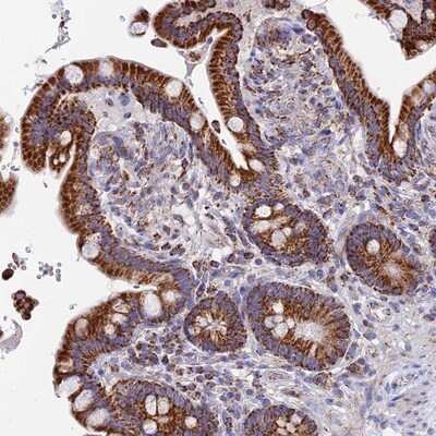 Immunohistochemistry-Paraffin: NDUFA5 Antibody [NBP1-88933]