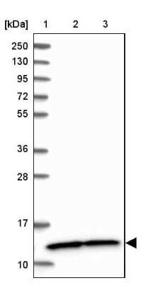 Western Blot: NDUFA5 Antibody [NBP1-88933]