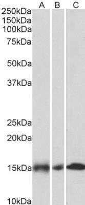 Western Blot: NDUFA7 Antibody [NBP2-26161]