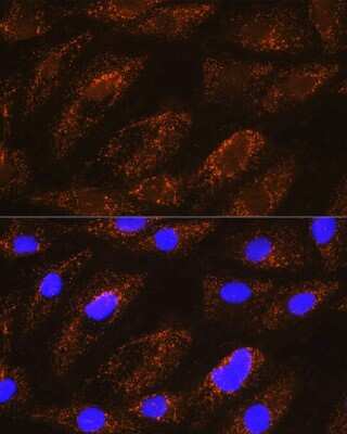 Immunocytochemistry/ Immunofluorescence: NDUFA8 Antibody - Azide and BSA Free [NBP2-93802]