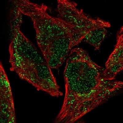 Immunocytochemistry/ Immunofluorescence: NDUFA9 Antibody [NBP2-57798]