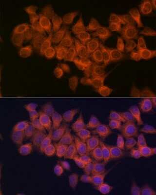 Immunocytochemistry/ Immunofluorescence: NDUFAF1 Antibody (4K8Y8) [NBP3-16313]