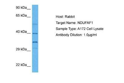 Western Blot: NDUFAF1 Antibody [NBP2-85366]