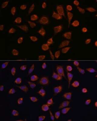 Immunocytochemistry/ Immunofluorescence: NDUFAF2 Antibody - Azide and BSA Free [NBP2-93263]