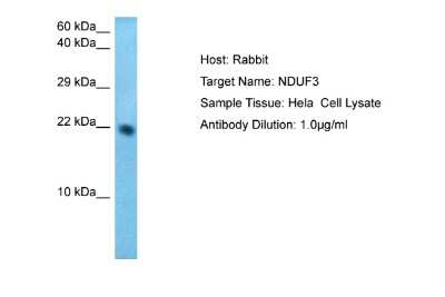Western Blot: NDUFAF3 Antibody [NBP2-85369]