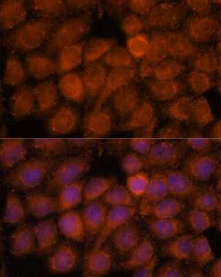 Immunocytochemistry/ Immunofluorescence: NDUFAF4 Antibody - Azide and BSA Free [NBP2-93264]