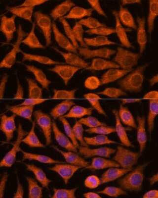 Immunocytochemistry/ Immunofluorescence: NDUFAF4 Antibody - Azide and BSA Free [NBP2-93264]