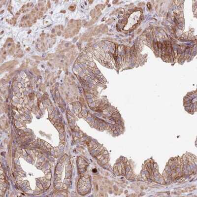 Immunohistochemistry-Paraffin: NDUFAF4 Antibody [NBP1-92171]