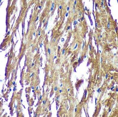 Immunohistochemistry-Paraffin: NDUFAF4 Antibody - Azide and BSA Free [NBP2-93264]