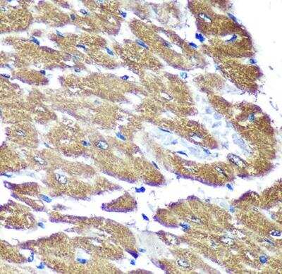 Immunohistochemistry-Paraffin: NDUFAF4 Antibody - Azide and BSA Free [NBP2-93264]