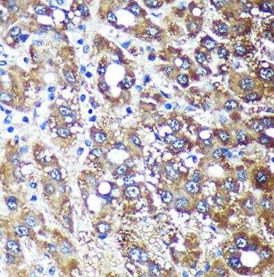Immunohistochemistry-Paraffin: NDUFAF4 Antibody - Azide and BSA Free [NBP2-93264]