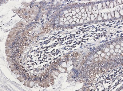 Immunohistochemistry-Paraffin: NDUFB1 Antibody (S04-4H3) [NBP3-19813]