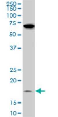 Western Blot: NDUFB11 Antibody (4B2) [H00054539-M08]
