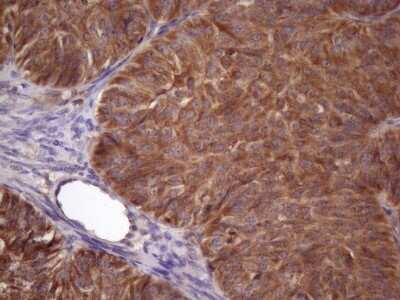 Immunohistochemistry: NDUFB11 Antibody (OTI9C5) [NBP2-46119]