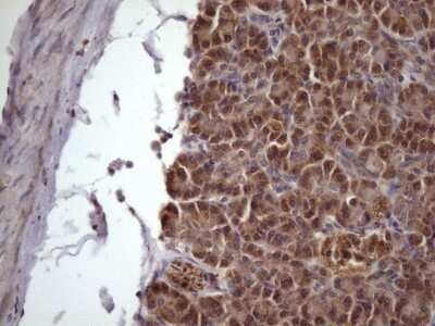 Immunohistochemistry: NDUFB11 Antibody (OTI9C5) [NBP2-46119]
