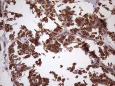 Immunohistochemistry: NDUFB11 Antibody (OTI9C5) [NBP2-46119]