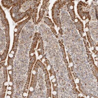 Immunohistochemistry-Paraffin: NDUFB11 Antibody [NBP1-83956]