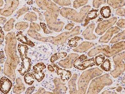 Immunohistochemistry-Paraffin: NDUFB11 Antibody [NBP3-12681]
