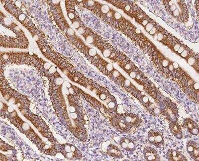 Immunohistochemistry-Paraffin: NDUFB11 Antibody [NBP3-12681]