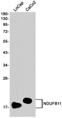 Western Blot: NDUFB11 Antibody (S08-7D9) [NBP3-15064]