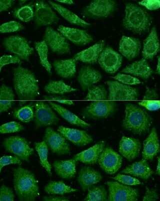 Immunocytochemistry/ Immunofluorescence: NDUFB3 Antibody - Azide and BSA Free [NBP2-93366]