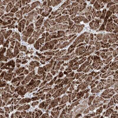 Immunohistochemistry-Paraffin: NDUFB3 Antibody [NBP1-88929]