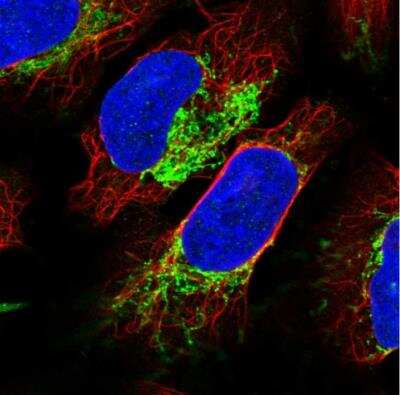 Immunocytochemistry/ Immunofluorescence: NDUFB4 Antibody [NBP2-33626]