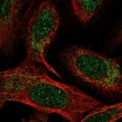 Immunocytochemistry/ Immunofluorescence: NDUFB4 Antibody [NBP3-17897]