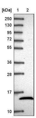 Western Blot: NDUFB4 Antibody [NBP2-33626]