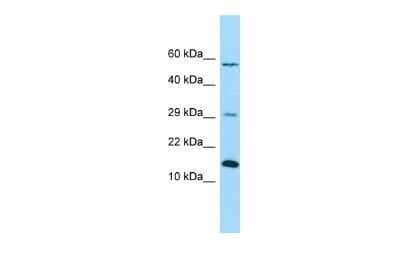 Western Blot: NDUFB4 Antibody [NBP2-85370]