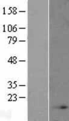 Western Blot: NDUFB4 Overexpression Lysate [NBL1-13552]