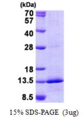 SDS-PAGE: Recombinant Human NDUFB4 His Protein [NBP2-23261]