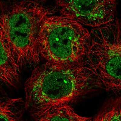 Immunocytochemistry/ Immunofluorescence: NDUFB6 Antibody [NBP1-92172]