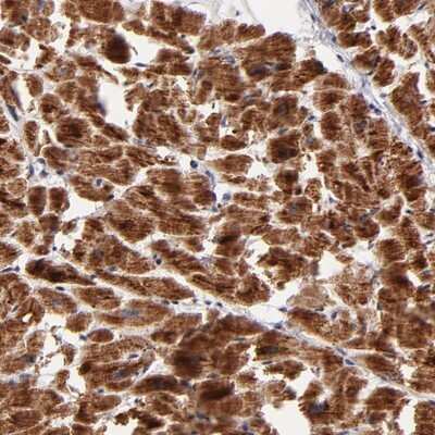 Immunohistochemistry-Paraffin: NDUFB7 Antibody [NBP1-88938]