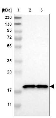 Western Blot: NDUFB7 Antibody [NBP1-88938]