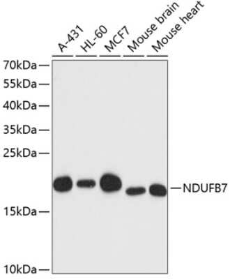 Western Blot: NDUFB7 AntibodyAzide and BSA Free [NBP2-94617]