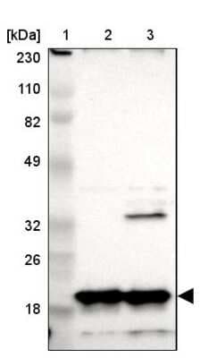 Western Blot: NDUFB8 Antibody [NBP1-88859]