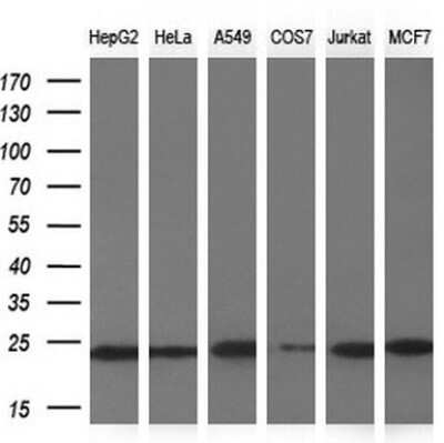 Western Blot: NDUFB9 Antibody (OTI13H11) [NBP2-46126]
