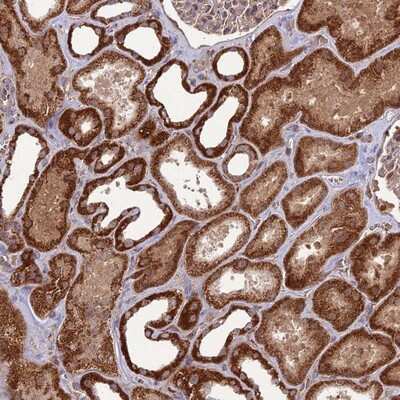 Immunohistochemistry-Paraffin: NDUFC1 Antibody [NBP1-83064]