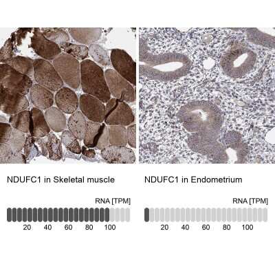 Immunohistochemistry-Paraffin: NDUFC1 Antibody [NBP3-17130]