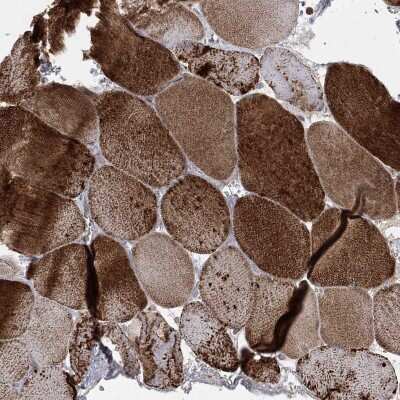 Immunohistochemistry-Paraffin: NDUFC1 Antibody [NBP3-17130]