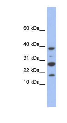 Western Blot: NDUFC1 Antibody [NBP1-54760]