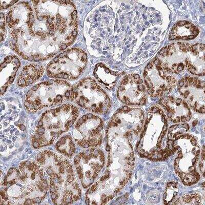Immunohistochemistry: NDUFC2 Antibody [NBP1-88934]