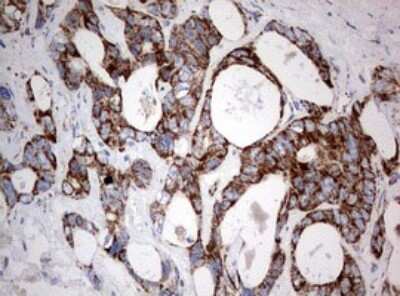 Immunohistochemistry: NDUFS2 Antibody (OTI1D5) [NBP2-46127]