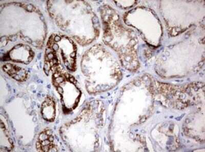 Immunohistochemistry: NDUFS2 Antibody (OTI1D5) [NBP2-46127]