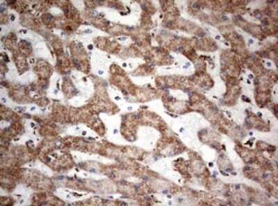 Immunohistochemistry: NDUFS2 Antibody (OTI1D5) [NBP2-46127]