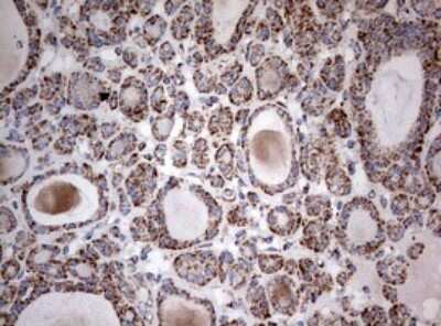 Immunohistochemistry: NDUFS2 Antibody (OTI1D5) [NBP2-46127]