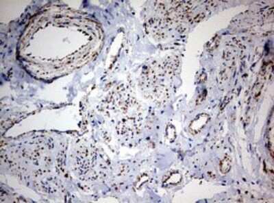 Immunohistochemistry: NDUFS2 Antibody (OTI1D5) [NBP2-46127]