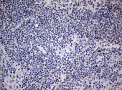Immunohistochemistry: NDUFS2 Antibody (OTI1D5) [NBP2-46127]